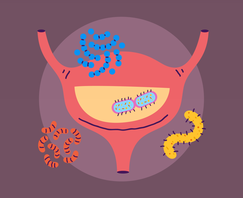 Цистит: симптомы и лечение_2